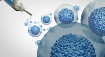 Stem cell treatments and osteoarthritis